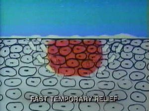 Cortizone Itch Cream Commercial (c.1990)