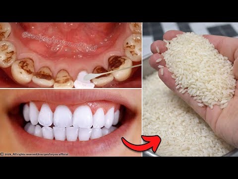 The secret that dentists are hiding from us!🔥It whitens teeth and eliminates tartar in 2 minutes🦷