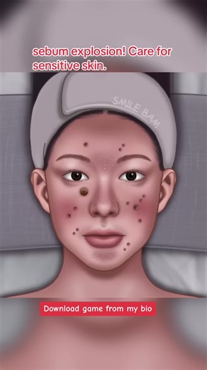 sebum explosion! Care for sensitive skin. #asmr #animation #satisfying #care #viral