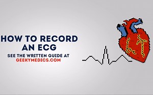 【搬运】心电图ECG操作示范