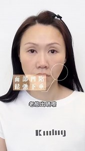 全港首批引入HArmonyCa™ 四合一美神針✨ ✅導師級醫療團隊主理✅近萬同類型針劑注射經驗 塊面滿佈細紋好易出賣年齡，試過哂坊間普通膠原針已經滿足唔到你🥹？ HArmonyCa™ 四合一美神針帶比你前所未有嘅雙效體驗，即時填充塑型，持久緊緻飽滿🧐 Beaunique將獨特嘅C Shape拉提＋哈佛輪廓固定打法二合一，效果自然就更顯著啦❤️～ 🧚🏻‍♀️HArmonyCa™ 四合一美神針🪄： ✅全港首批引入，美國名廠製造，結節低 ✅100%原廠正貨，保證即場開封 ✅即時效果，立即豐顏滿滿光澤感 ✅零空窗期，第1星期開始生膠原 ✅一針四效：提拉、緊緻、保濕、膠原增生 ✅C Shape拉提 ＋ 獨家哈佛輪廓固定打法，定點支撐輪廓，效果更持久 ✅駐場導師級醫療團隊主理 ——————————————————— 👑Beaunique Medical｜真正醫學主導 📍港島區旗艦店：香港銅鑼灣告士打道280號世貿中心20樓02-03室（港鐵銅鑼灣站D1出口） 📍九龍區旗艦店：九龍旺角登打士街56號家樂坊11樓11室（港鐵油麻地站A2出口） 📱Whatsapp查詢：https://