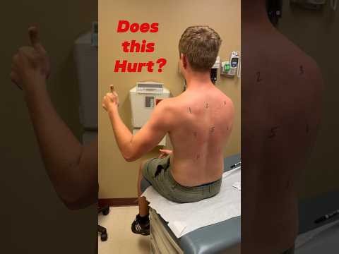 Does Allergy Skin Testing Hurt? What to Expect.