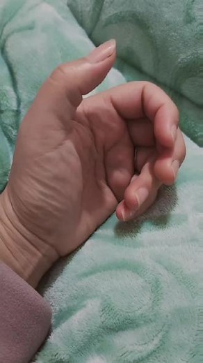 腱鞘炎折磨了我几个月，有没有治疗的好办法？可以除根。从一开始的疼、到拇指有弹响，现在早上醒来用力都伸不直了。干活碰到一下都疼的受不了……#腱鞘炎能自愈吗