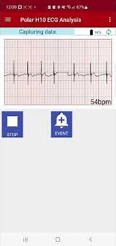 Polar H10 ECG Analysis from Biosignal Solutions on Android