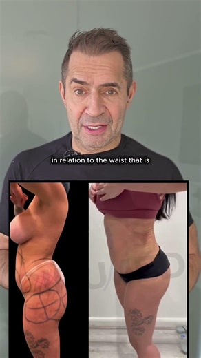 Is Your Waist Wider than Your Hips? Here's How to Correct an Inverted Triangle