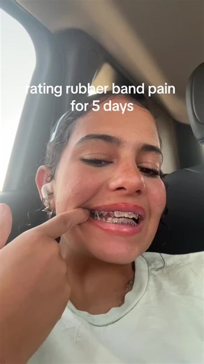 Braces Guy: Dealing with Rubber Bands Pain