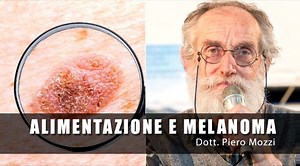 𝗔𝗟𝗜𝗠𝗘𝗡𝗧𝗔𝗭𝗜𝗢𝗡𝗘 𝗘 𝗠𝗘𝗟𝗔𝗡𝗢𝗠𝗔 C'è una relazione tra la comparsa dei Melanomi e la nostra alimentazione? A questa domanda risponde il dottor Mozzi nel video che segue. Per maggiori info sulla dieta del dottor Mozzi, consulta il libro: https://www.macrolibrarsi.it/libri/__la-dieta-del-dottor-mozzi-libro-pietro-mozzi-libro.php?pn=4565 | Dieta del gruppo sanguigno