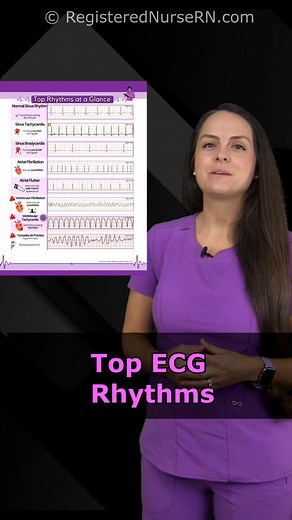 Nurse Sarah on Instagram: "Here are some of the top ECG rhythms you want to know. If you are struggling with ECG interpretation, I have a HUGE playlist on YouTube that you can watch for free, which includes ECG interpretation, key points about heart rhythms, and much more. I also just released ECG rhythm cheat sheets on shop.registerednursern.com #ecg #ekg #ecginterpetation #heartrhythms #nursing #nclex #nursingschool #nursingnotes #nurse"