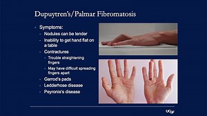 VIDEO: Lumps and Bumps of the Hand and Wrist