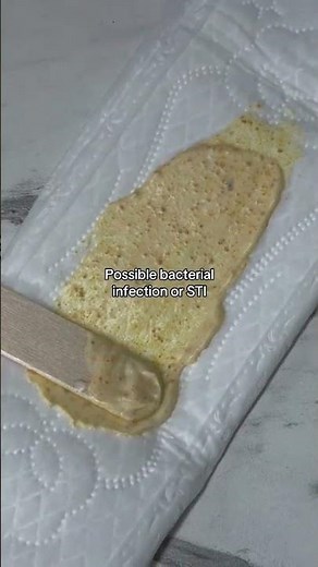 Vaginal Discharge Colors Explained: What’s Normal and When to See a Doctor