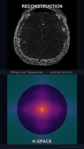 MRI K-Space Decomposition: Real-Time Filtered Fourier Transform