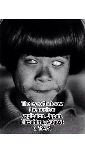 The eyes that saw the nuclear explosion. Japan, Hiroshima, August 8, 1945 #history #hiroshima #1945