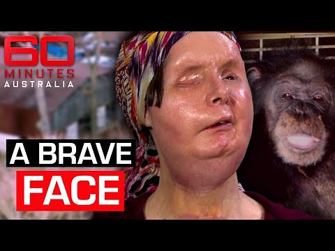 Single mother’s extraordinary survival story after violent chimpanzee attack | 60 Minutes Australia