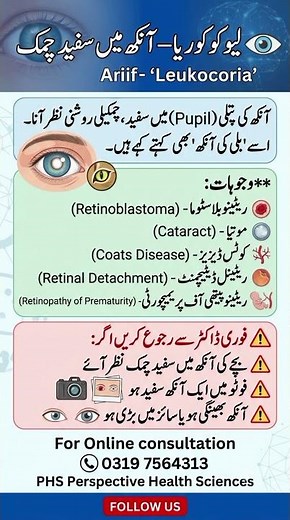 Leukocoria | White Pupil in Children | #eyehealth #eyecare