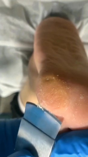 31K views · 176 reactions | Foot care #nailsofinstagram #nailartist #challenge #viralvideochallenge #viralvideoシ #ContentMonetization #creator #challenge #fallvibesnail | Nature's | Facebook