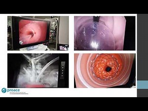 Introducción a la simulación de endoscopía digestiva