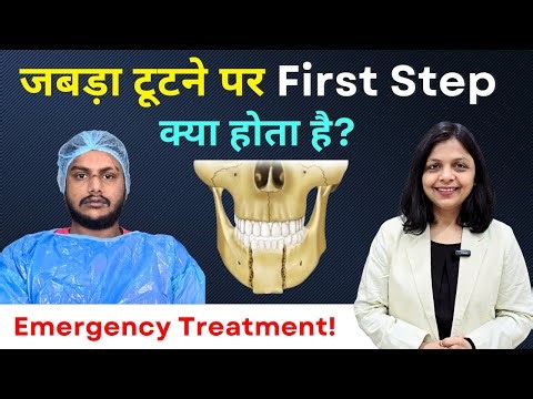 Jaw Fracture Treatment (Mandible Break)| जबड़ा टूटने का सबसे सही इलाज | Broken Jaw Surgery #fracture