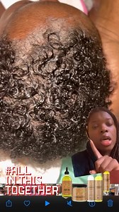 How to remove cradle cap safely and minimize hair fall This allows you to remove it without vigorously combing/scraping it out of the scalp. You also have the luxury if using 100% vegan, homemade product with clean and safe ingredients made with babies in mind follow @lachelbeaute for more tips! #lachelbeaute #CradleCapCare #BabyScalpSolutions #GentleBabyCare #NaturalRemedies #HealthyBabySkin #CradleCapRelief #BabySkincare #ScalpCareForInfants #SoothingBabyScalp #CradleCapNoMore #reels #reelsins