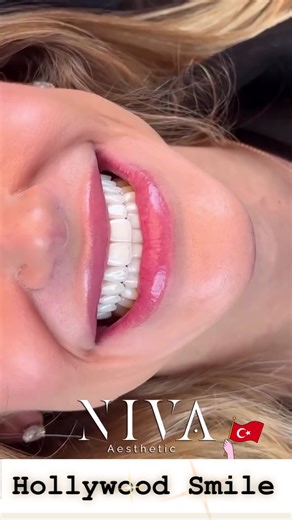 #november #HollywoodSmile #SmileMakeover #oceandrive #hollywood