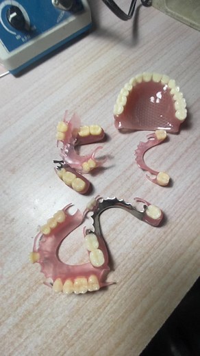 Prótesis dentales: Tipos y características en Clínica Glowingsmiles