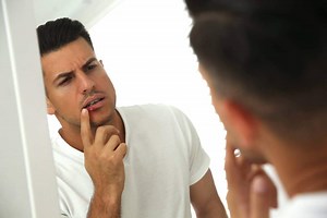 Cold Sore Laser Treatment: Everything You Need to Know