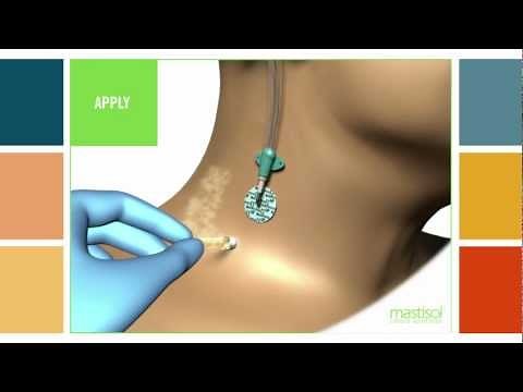 Mastisol® Liquid Adhesive Vial Application Instructions