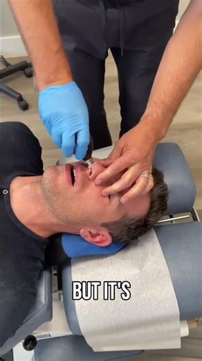 Why Doctors Use Balloons in the Nose 😱