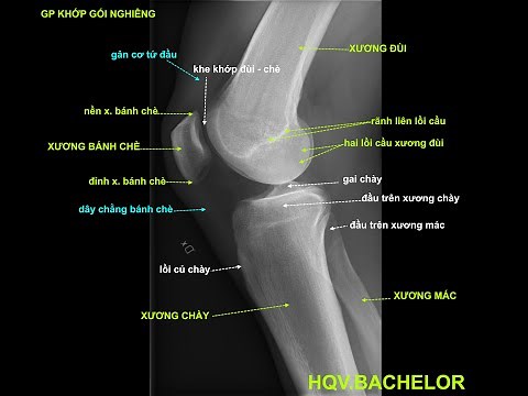 X quang khớp gối nghiêng (Xray anatomy of knee)