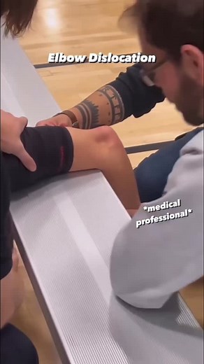 Dr. Tom Walters, DPT, OCS on Instagram: "💥𝐄𝐥𝐛𝐨𝐰 𝐃𝐢𝐬𝐥𝐨𝐜𝐚𝐭𝐢𝐨𝐧💥 —— 👉A posterior elbow dislocation occurs when the ulna and radius shift backward relative to the humerus, most often from a fall onto an outstretched hand with the elbow extended. 🔎This force can stretch or tear key stabilizing structures, including the ulnar and radial collateral ligaments, joint capsule, and surrounding muscles. While the bony fit of the elbow provides stability, high-energy trauma can overcome th