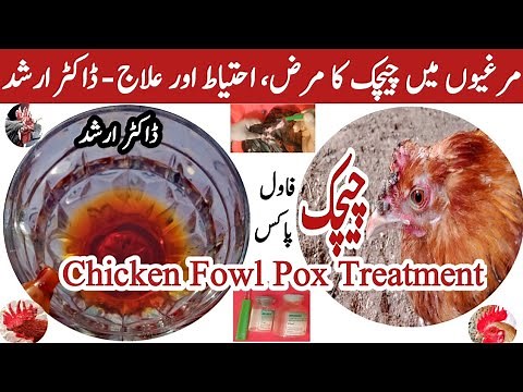 Chicken Fowl Pox Treatment | Chicken Pox Causes, Sings, Symptoms & Prevention | Dr ARSHAD