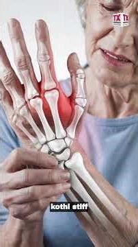 Joint Stiffness & Hand Pain? It Could Be Rheumatoid Arthritis | Dr. Kumar Bhanu