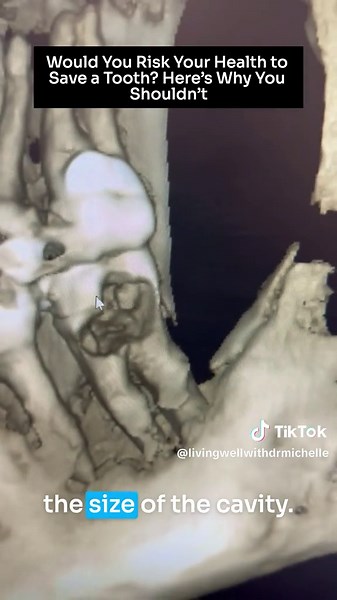 Understanding Cone Beam CT For Tooth Health