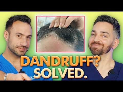 8 Dandruff Hacks that Will Change Your Life | Doctorly’s Guide