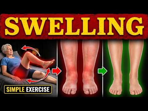 Swollen Legs and Ankles After 60? Do These 5 Simple Exercises | Senior Health Tips