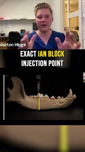 This IAN Block Trick Will Change Your Next Injection #vetdentist #IANblock #mortenvetdentistry