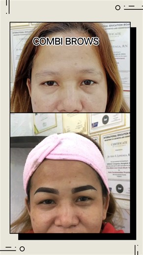🔥 COMBI BROWS✨ Before & After #radianceaestheticclinicdavao #BONIFACIOSTREETDAVAOCITY #DavaoLifeIsHere #microshading #microblading # | Radiann'ce Aesthetic Clinic - Davao