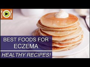 Best Foods for Eczema | Healthy Recipes
