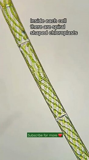 Spirogyra under the microscope | Structure of spirogyra, algae | Biomedictation #shorts #neet