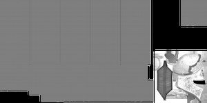 How Can I Get Past This "Accessory Texture Limit"?