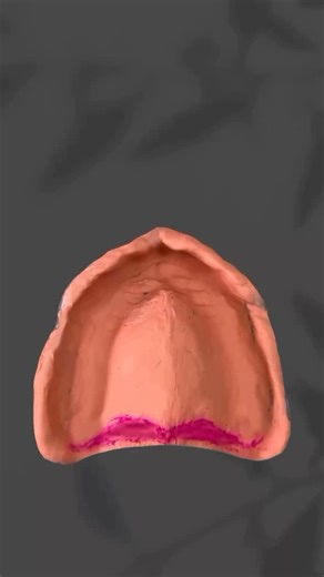 @canvas.of.smiles Great dentures start with great teamwork!🤝✨ To get a perfect fit, we need to understand the muscles that shape the borders. If we don’t know where they are or what they do, how can we make sure our impressions are right? It’s not just about following steps—it’s about knowing why we do them. Movements like “open wide” or “side to side” aren’t just random—they help shape the denture to match your natural function. During border molding, both the dentist and the patient play an a