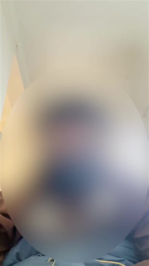 #fyp #usa #mosquito #snail #leech | Snail