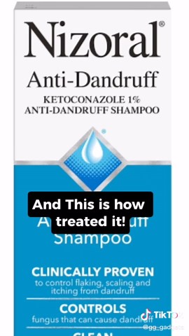 Understanding Malassezia Infection and Its Treatment