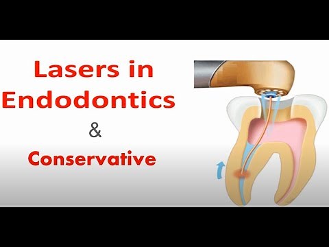 LASERS IN ENDODONTICS AND CONSERVATIVE DENTISTRY