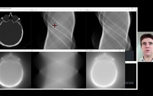 deep learning iterative image reconstruction (embeds a CNN in MLEM) Andrew Reade