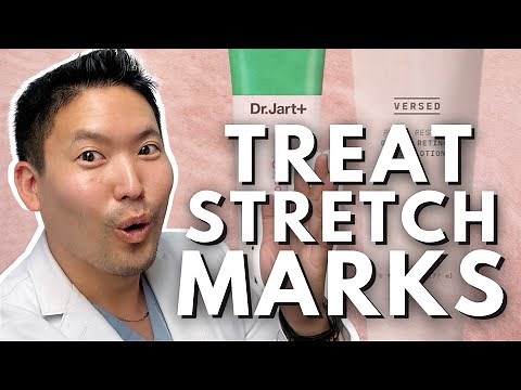 Evidence Based Ways to Treat Stretch Marks