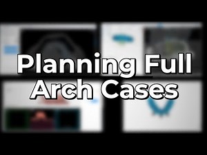 Full Arch Implant Planning (All on X) _ Advanced Module _ Atomica AI