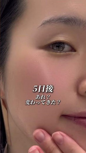 ホワイトデー前の顔ダニの撲滅方法❣️絶対やってみて💗#垢抜け #クレンジングオイル #自分磨き #かわいい #毛穴 pr