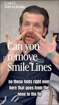 What are smile lines (nasal folds) and can surgery remove them?