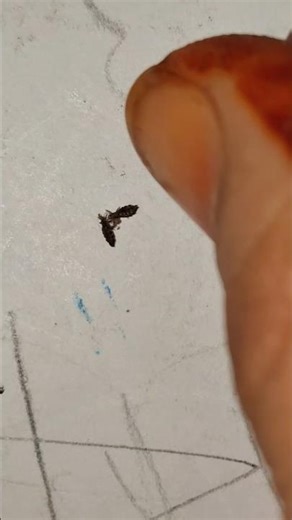 How fast do Lice Multiply?#shorts #ytshorts #ytviral #viral #trending #fypシ゚viral #new #usa