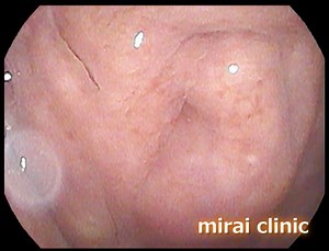 コロナワクチンによると思われる長期副反応（後遺症）について - 福岡のみらいクリニック